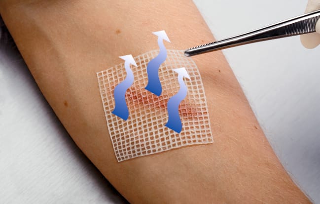 Cuticell® Classic Bild 1